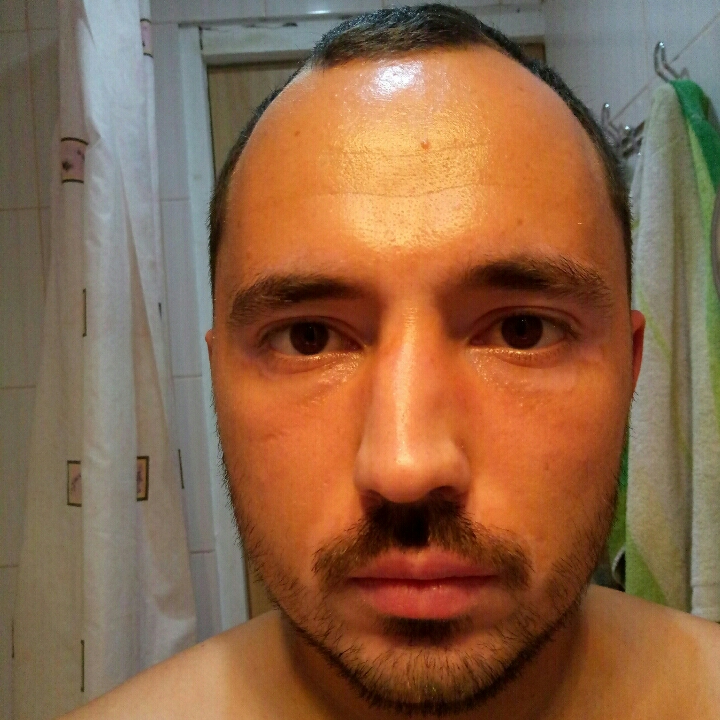 Александер У.
